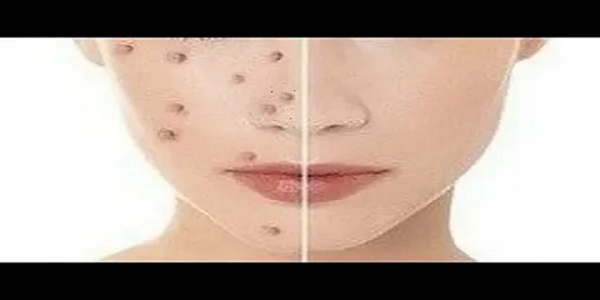 تصویر 2 از قیمت خرید کرم گیاهی لدورا + فروش ویژه